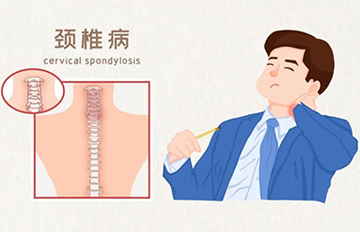 警惕！骨與關節(jié)的“健康危機”，你中招了嗎？